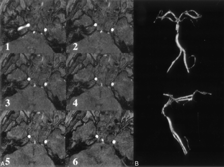 Fig 3.