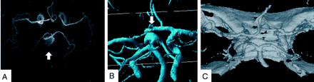 Fig 3.