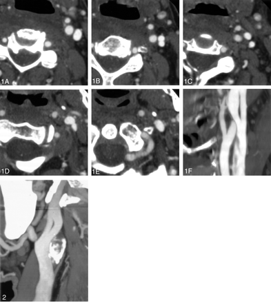 Fig 2.
