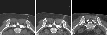 Fig 1.