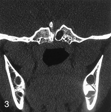 Fig 3.