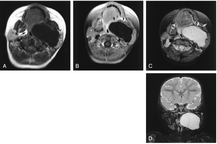 Fig 1.