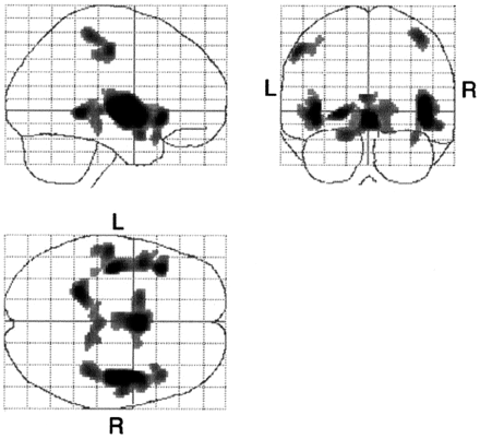 Fig 1.