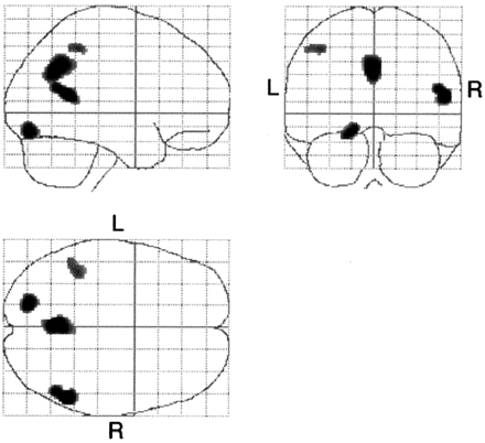 Fig 3.