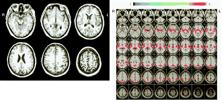 Fig 6.