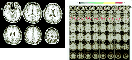 Fig 8.