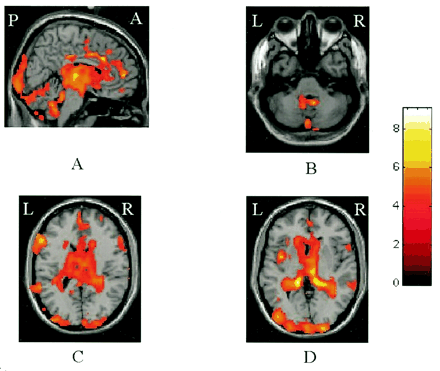 Fig 1.