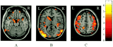 Fig 3.