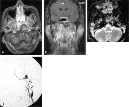Fig 1.