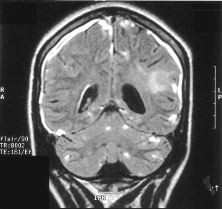 Fig 4.