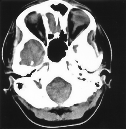 Fig 1.