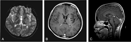 Fig 2.