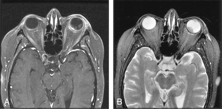 Fig 1.