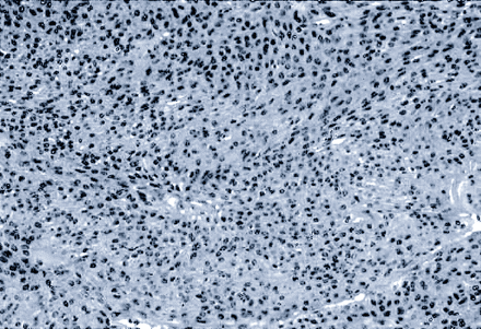 Fig 3.