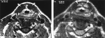Fig 2.