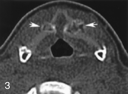 Fig 3.