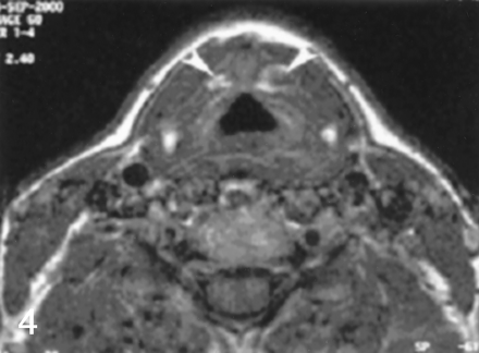 Fig 4.
