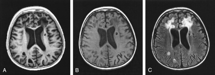 Fig 4.