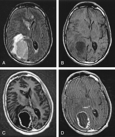 Fig 5.
