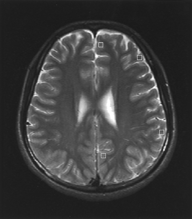 Fig 1.