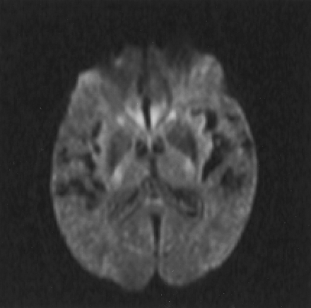 Fig 8.