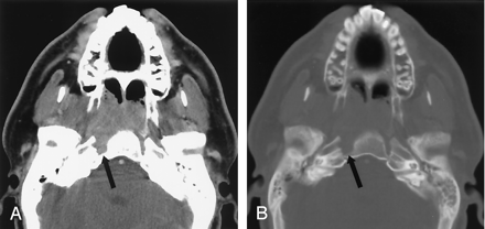 Fig 3.