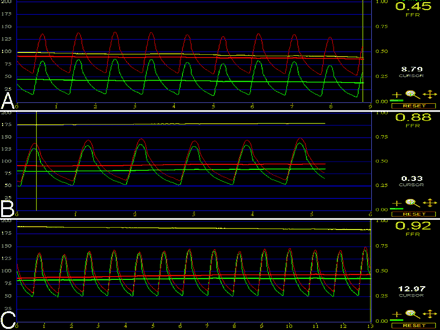 Fig 2.