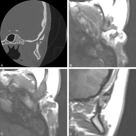 Fig 2.