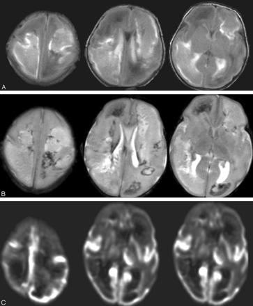Fig 3.