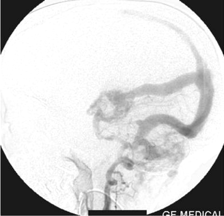 Fig 5.