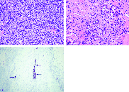 Fig 2.