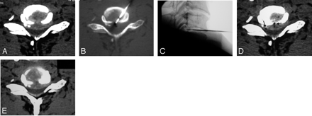Fig 3.