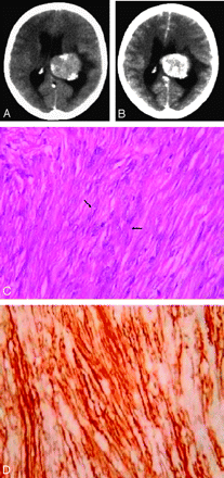   Fig 1. 