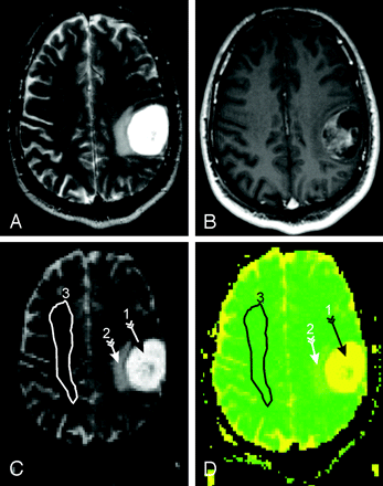Fig 1.