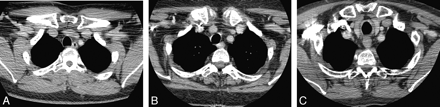 Fig 4.