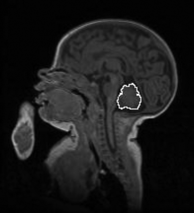 Fig 1.