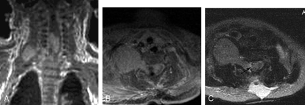 Fig 5.