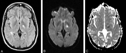 Fig 2.