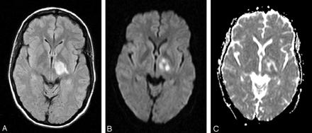 Fig 3.