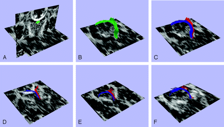 Fig 2.