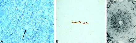 Fig 2.