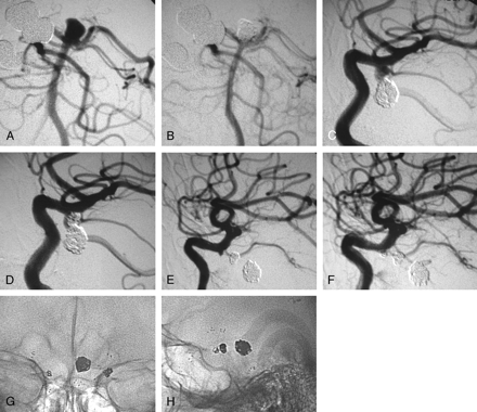 Fig 3.