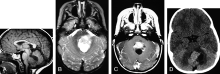 Fig 1.