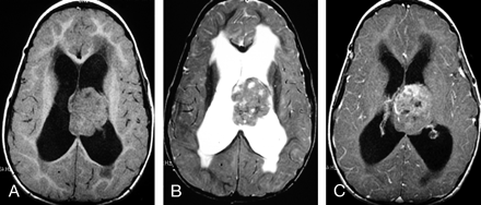 Fig 5.