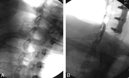 Fig 2.
