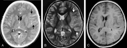 Fig 2.