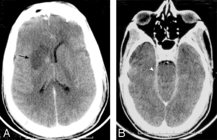 Fig 5.