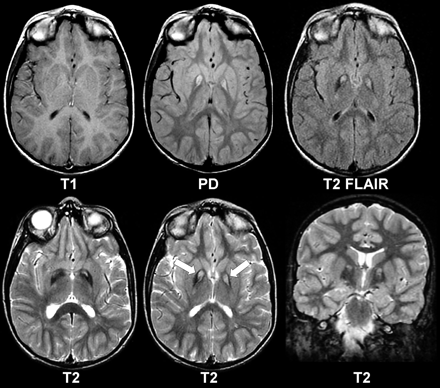 Fig 1.