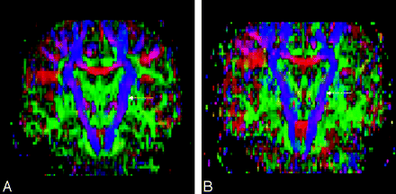 Fig 2.