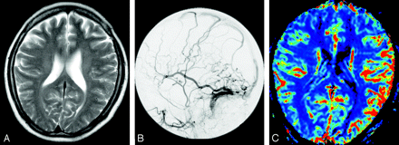 Fig 2.